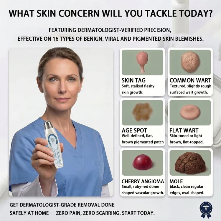 SAY GOODBYE TO YOUR WART & SPOTS !✋