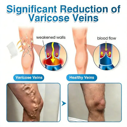 VeinRepair Microneedle Patch Roll 🦵✨ Comfortable Daily Care for Smoother, Refreshed-Looking Legs