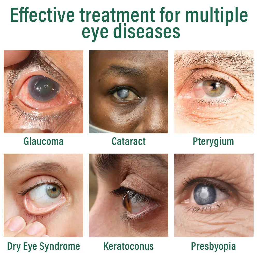 👩‍⚕️Freedaze® Nano Eye Drops Serum ✅FDA Approved(Suitable for presbyopia, dry eye syndrome, glaucoma, and cataracts) 🌷