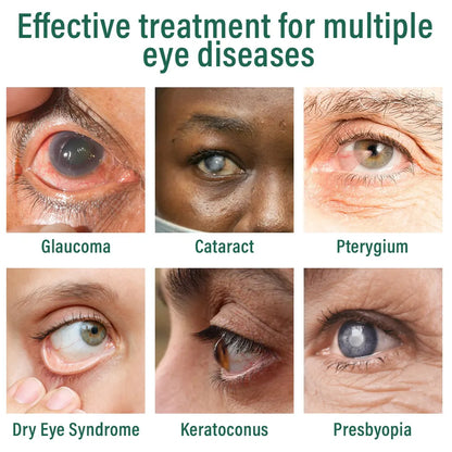👩‍⚕️Freedaze® Nano Eye Drops Serum ✅FDA Approved(Suitable for presbyopia, dry eye syndrome, glaucoma, and cataracts) 🌷
